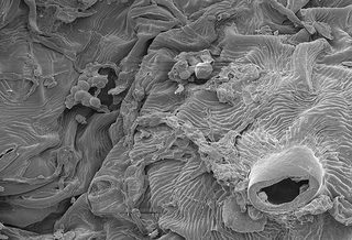 Illustration for article titled Tentacled Fungus Attacks The Microverse